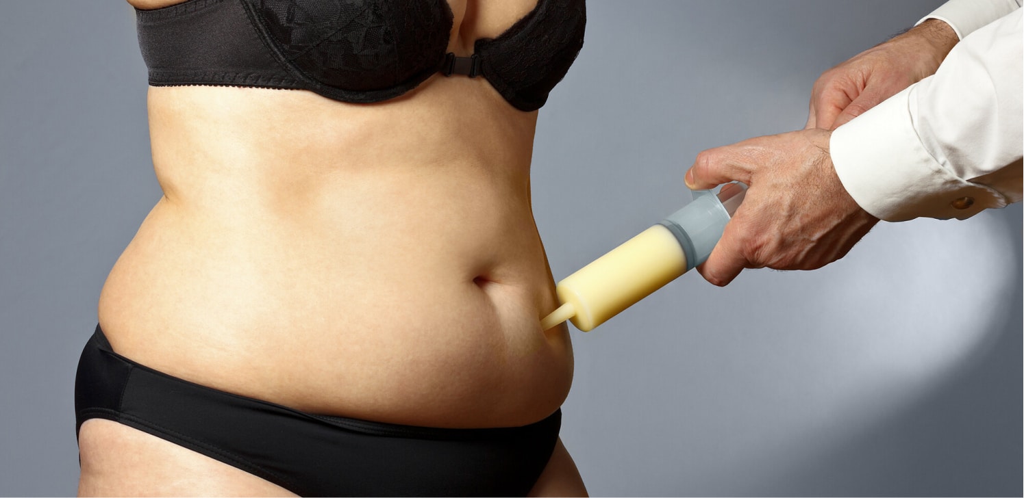 Coolsculpting vs Liposuction: 10 Reasons Why Coolsculpting Is Your Best Option